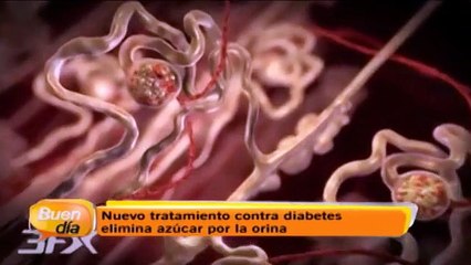 Nuevo tratamiento contra diabetes elimina azúcar por la orina