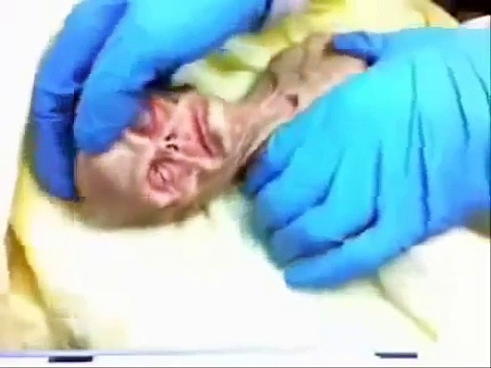Autopsia extraterrestre óvni cae en Rusia RUSSIAN ALIEN  AUTOPSY VIDEO REAL