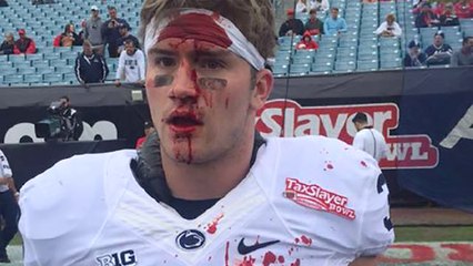 Penn State LB Slams Head Into Teammates Helmets Pregame, Bleeds All Over