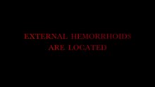 How Long Do External Hemorrhoids Last?