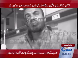 Rivals stich together opponets lips with steel wire over land dispute