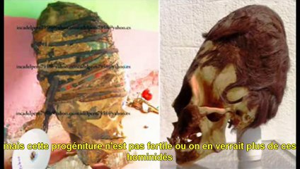 Une ex employée de la Banque Mondiale parle d'une deuxième espèce  avec des crânes allongés ?