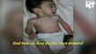 Syrian Baby Girl Is Starving In Madaya