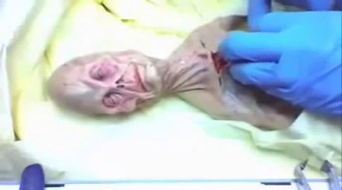 alien in Russia in 1969 UFO OVNI. (autpsia a alien en rusia en 1969) SHOCK