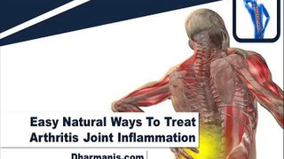 Easy Natural Ways To Treat Arthritis Joint Inflammation