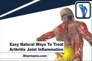 Easy Natural Ways To Treat Arthritis Joint Inflammation