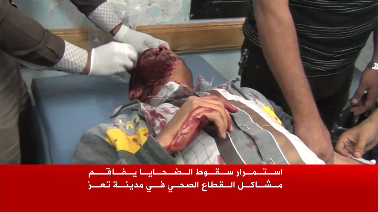 اتهام يمني للحوثيين باستخدام التجويع سلاحا ضد المدنيين