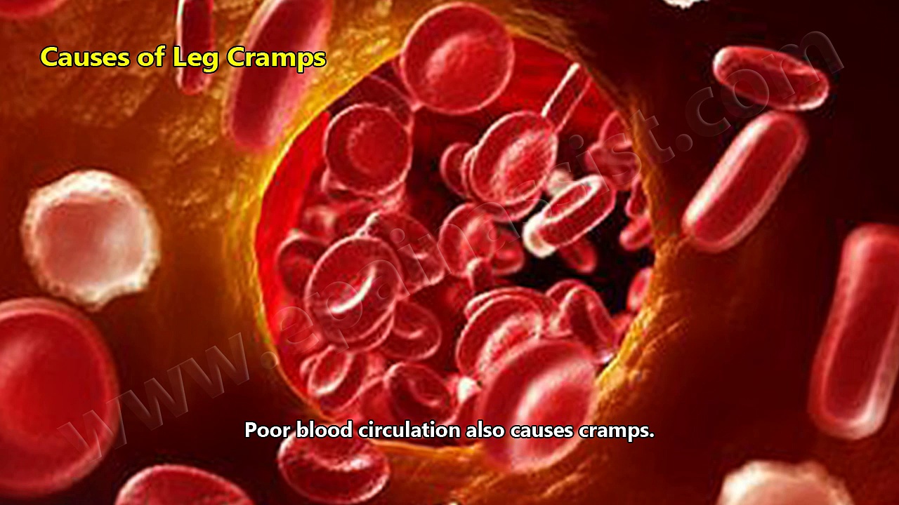 Leg Cramps: Treatment, Causes, Prevention