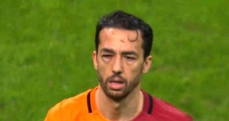 Bilal Kısa Bir Hafta Yok