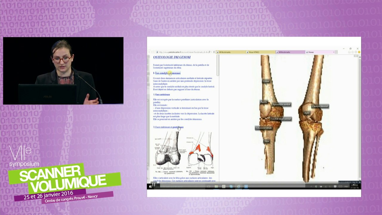 Application Vizua - Jeunes pousses industrielles