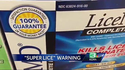 Super lice spreads throughout U.S.