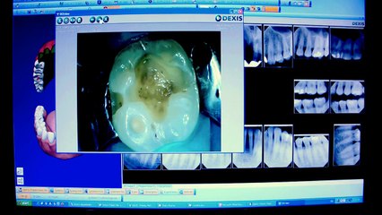 Oasis Dental Milton | Cosmetic,Braces,Dental Implant,Kids,TMJ Headache