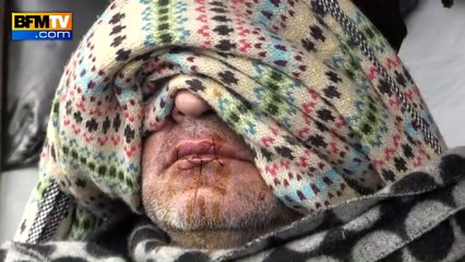 Calais: des migrants se cousent la bouche pour protester