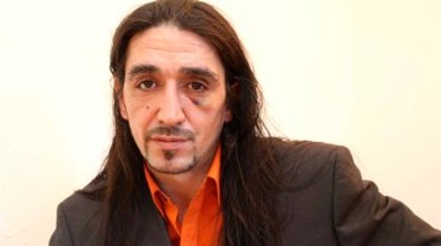 Almanya'da PKK'lıların Saldırısına Uğrayan Türk: Polis Bana Değil Onlara Yardım Etti