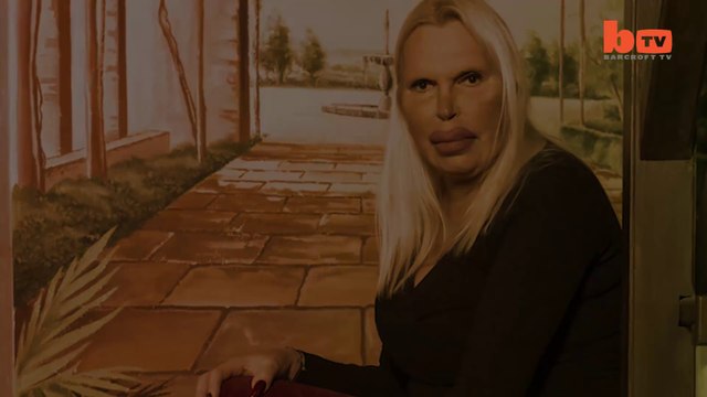 Cette femme trans dépense 76000$ en chirurgie esthétique... Dingue