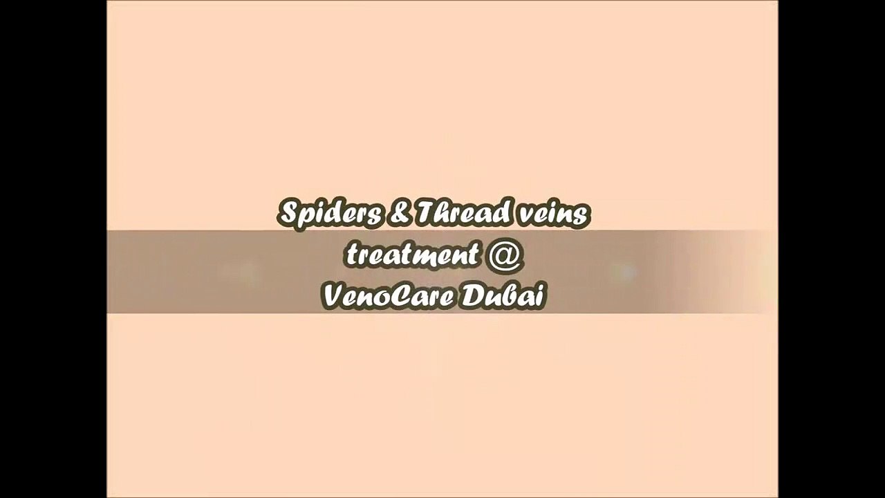 Varicose Vein Doctor in Dubai - VenoCare +971 52 993 6643