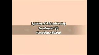 Varicose Vein Surgery in Dubai +971 52 993 6643