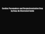 Cardiac Pacemakers and Resynchronization Step by Step: An Illustrated Guide [PDF Download]