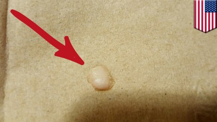 サラダに混入した人間の指先