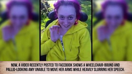Shocking Before-And-After Drug Use Photos