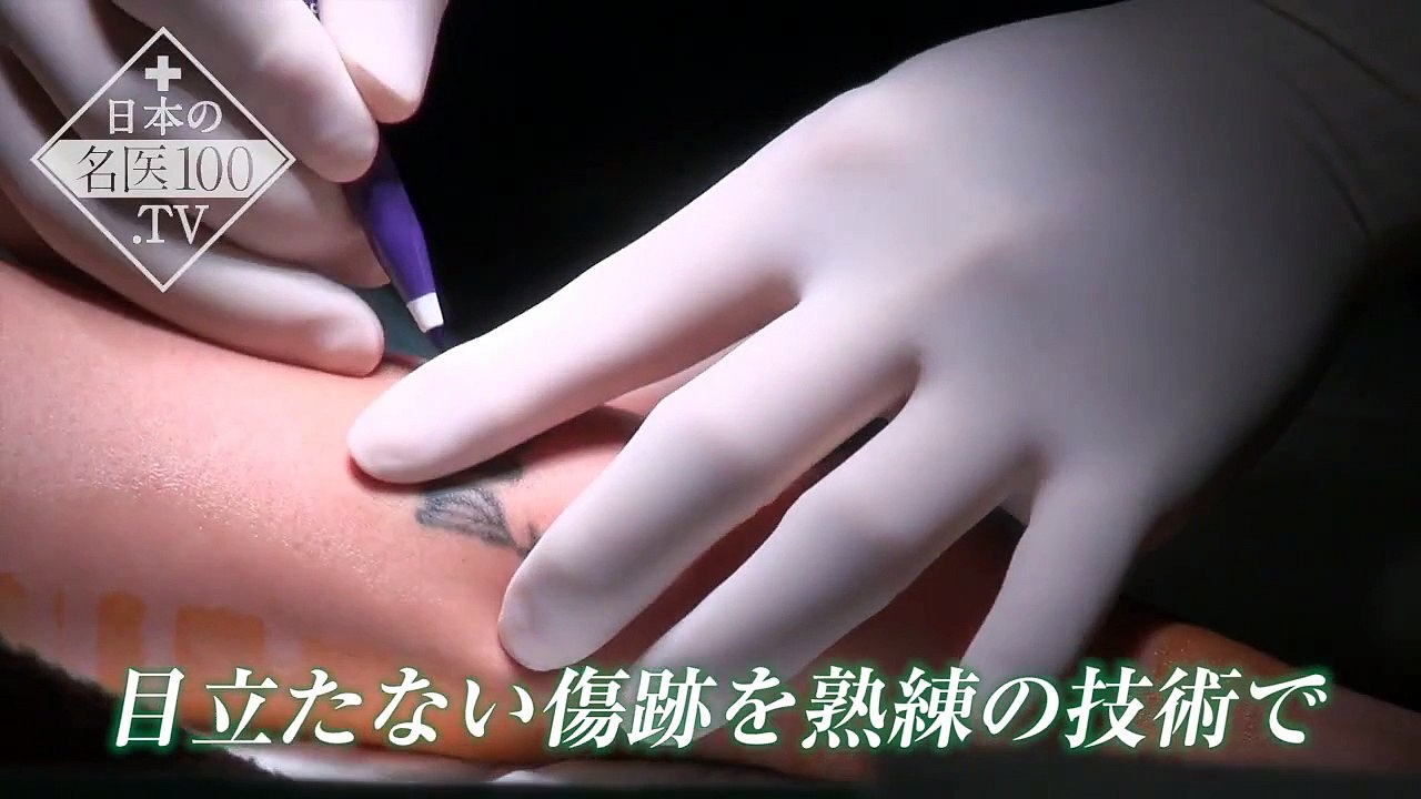 「タトゥ―（刺青）の除去症例は30年間で5,000件を超える」神の手を持つドクター 吉種克之　〜日本の名医100.TV〜