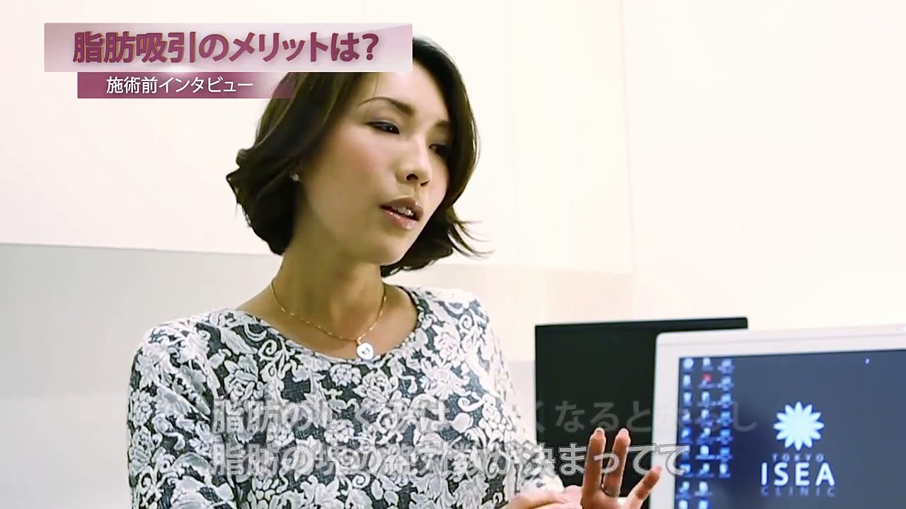 脂肪吸引のメリットとは？｜吉井奈々さんインタビュー第1回①