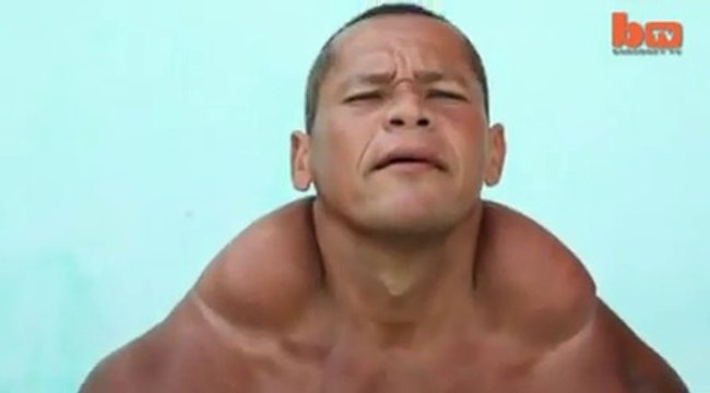 Portuguese bodybuilder who was teased for being thin may have taken it too far