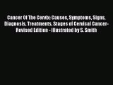 [PDF Download] Cancer Of The Cervix: Causes Symptoms Signs Diagnosis Treatments Stages of Cervical