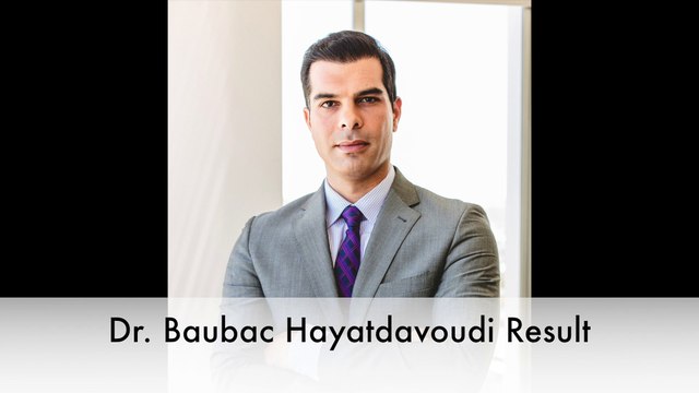 The Alvi Armani Clinic - FUE Hair Transplant Video