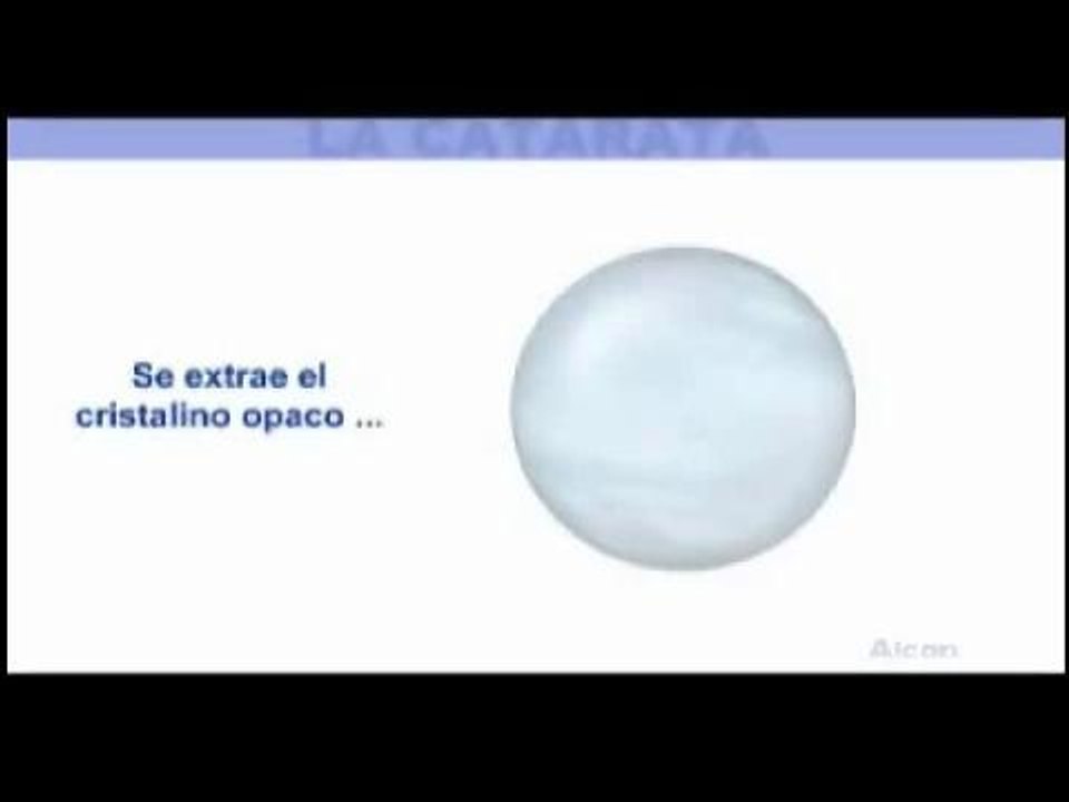 QUE SON LAS CATARATAS