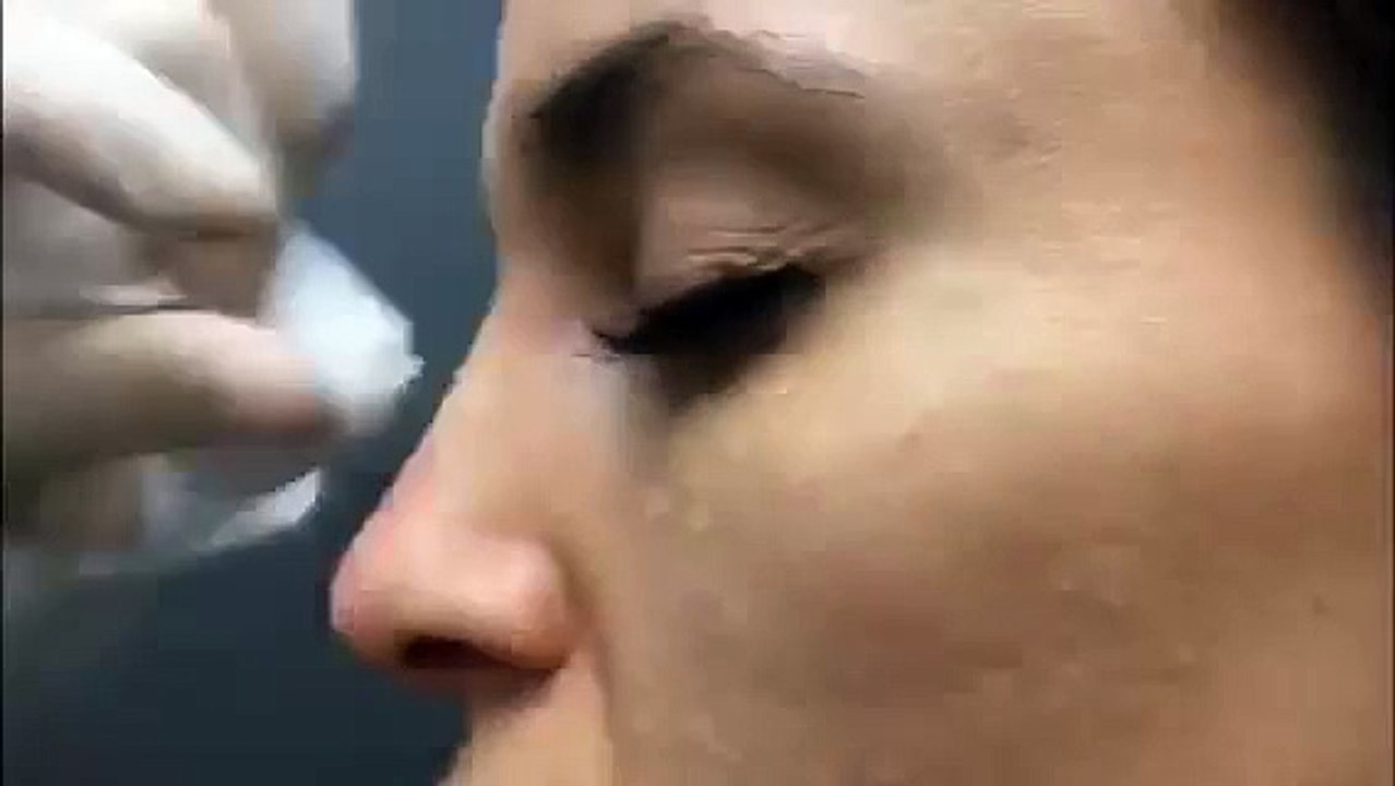 Crean método para transformar tu nariz sin operaciones