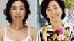 Korean Plastic Surgery: Shocking Before And After Photos