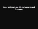 Lupus Erythematosus: Clinical Evaluation and Treatment [Download] Online