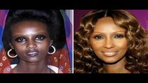 Celebrities Skin Bleaching Secrets (Beyonce)