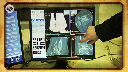 Do Hobbit-Like Creatures Really Exist?