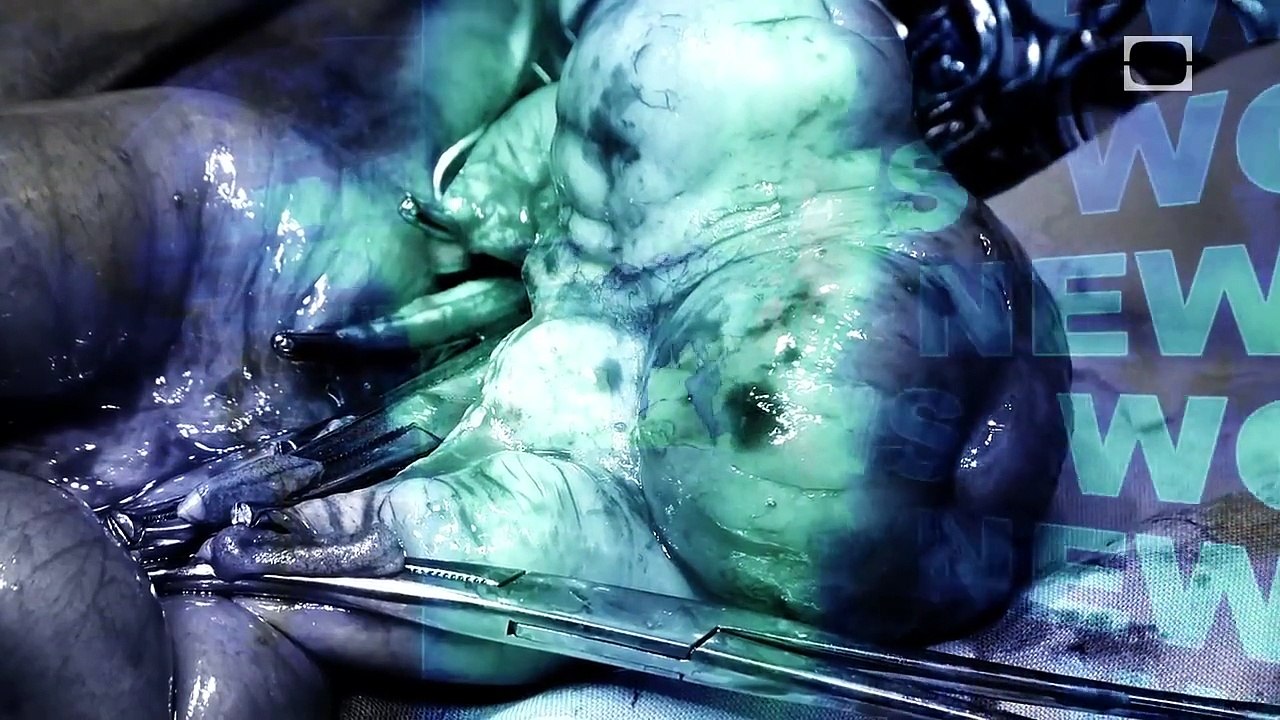 Human Experimentation: Part 2