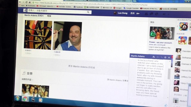 1341 Online treatment finger 手指頭腫