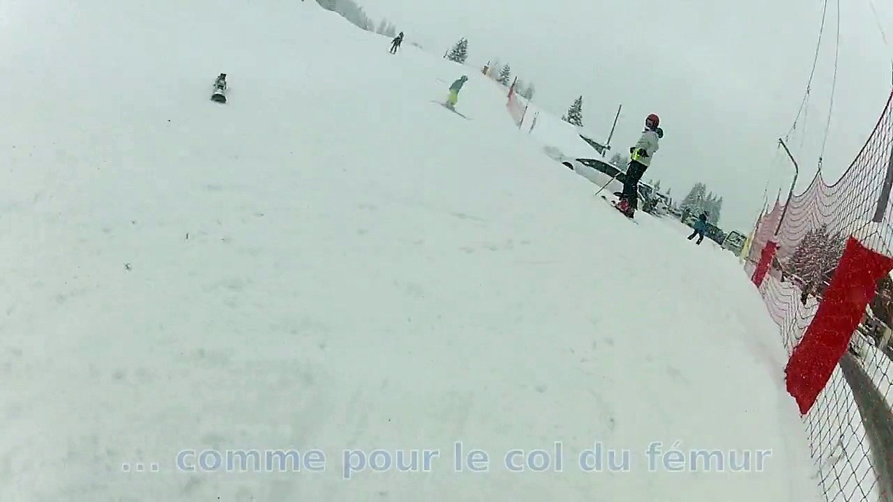 Peuf et cassage de côte à la Croix Fry