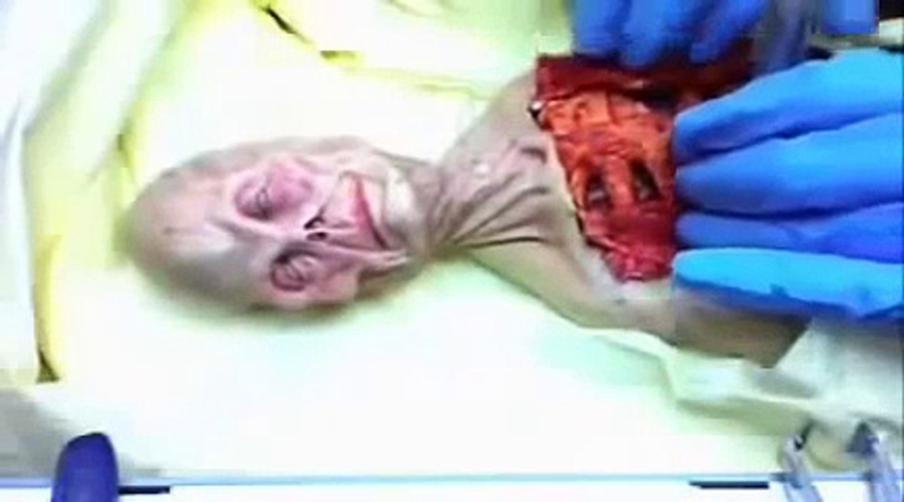 Top Secret KGB Files - Alien Autopsy in Russia 1969