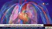 صحة- 200 حالة إصابة بإرتفاع ضغط الدم الرئوي سنويا في الجزائر