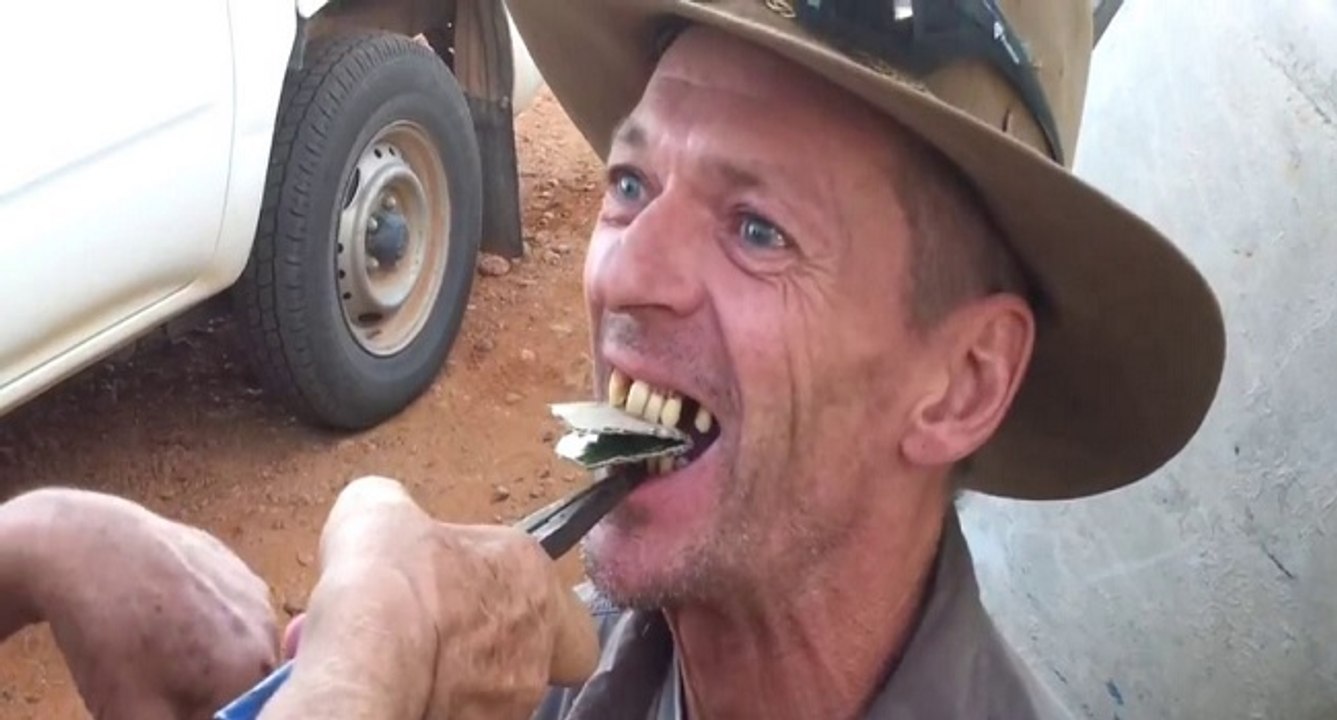 Se faire arracher les dents comme un Australien