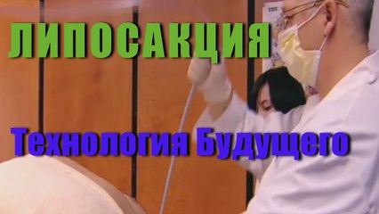 Супер Липосакция - Технологии Будущего