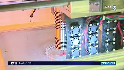 Santé : de la peau humaine fabriquée par une imprimante 3D