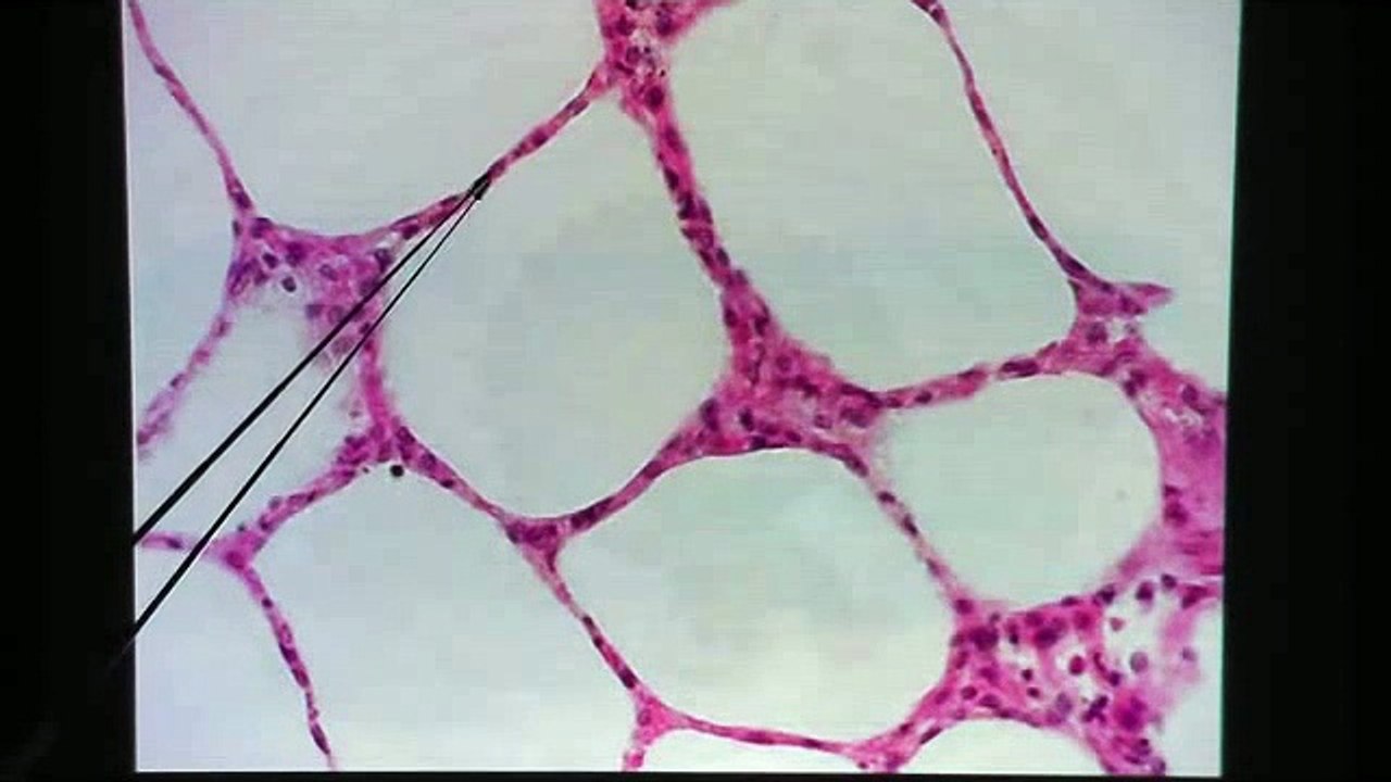 Simple Squamous Epithelium