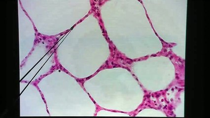 Simple Squamous Epithelium