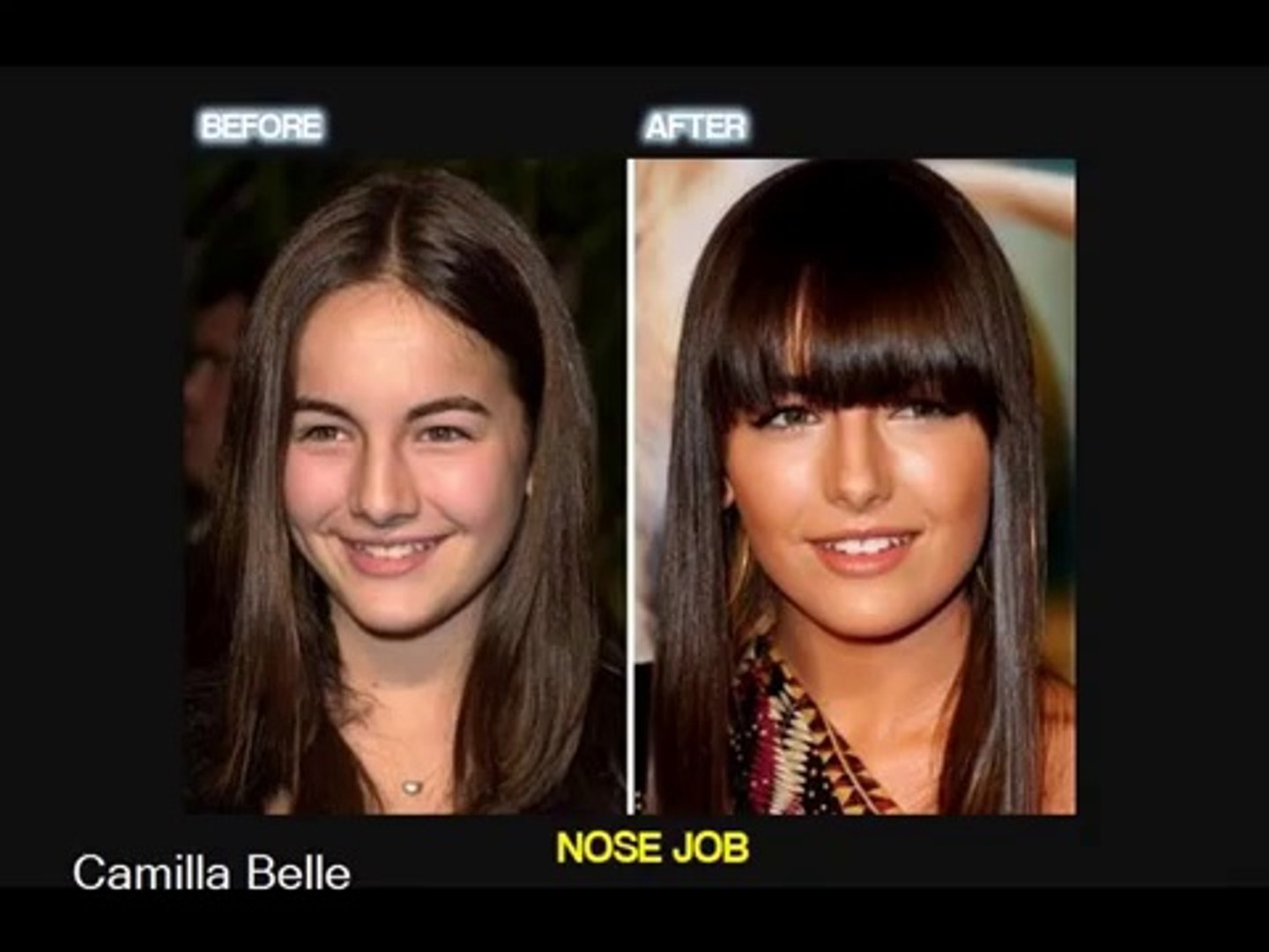 Celebrity Plastic Surgery (before and after)