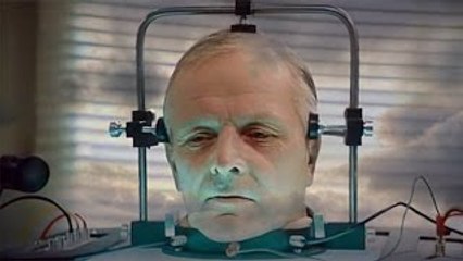 DOCUMENTAL ► EL PRIMER TRANSPLANTE DE CABEZA - // RazaDesconocida