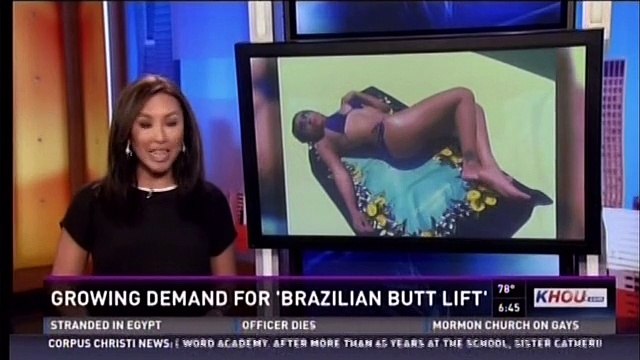 Brazilian Buttock Lifts by Dr. Franklin Rose, Houston Texas