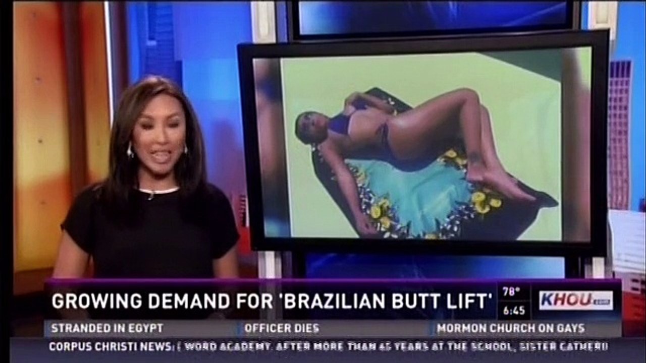 Brazilian Buttock Lifts by Dr. Franklin Rose, Houston Texas