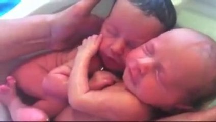 Des jumeaux inséparables a la naissance, trop mignon!